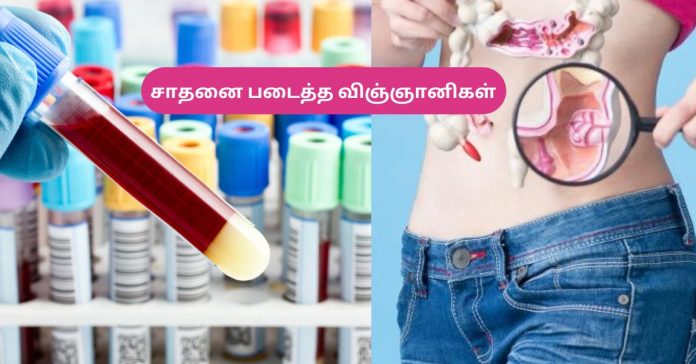 Discovered the Drug for Cancer பொது அறிவு செய்திகள்