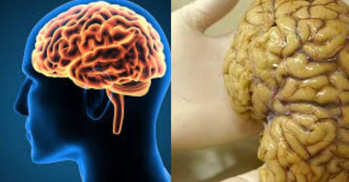 brain Virus சிறுவர்களுக்கான உலக செய்திகள்