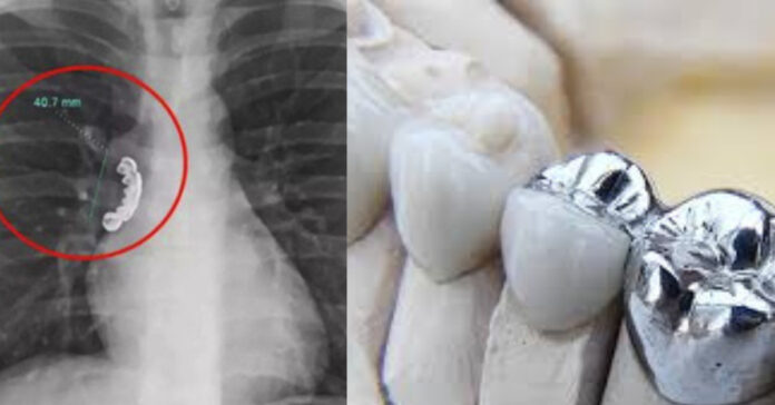 Kids News Silver teeth swallowed சிறுவர்களுக்கான உலக செய்திகள்