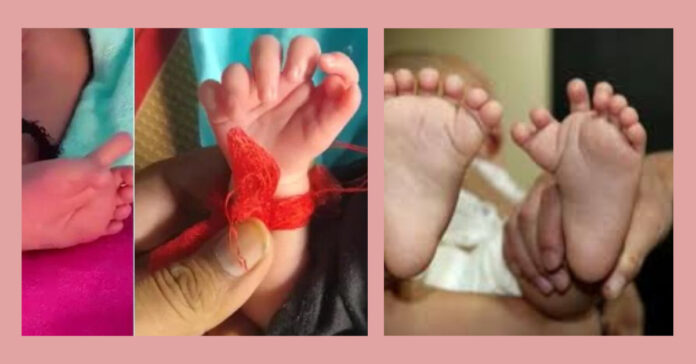 26 fingers childbirth சிறுவர்களுக்கான உலக செய்திகள்