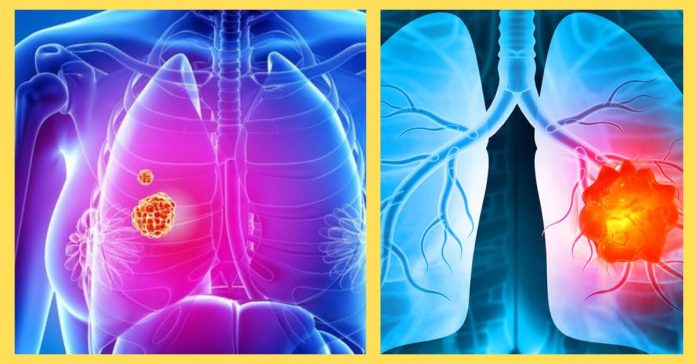 Lung Cancer in Tamil சுகாதாரம்